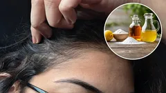 Quais são as vantagens de usar vinagre e bicarbonato de sódio para remover os cabelos brancos e como fazê-lo corretamente?